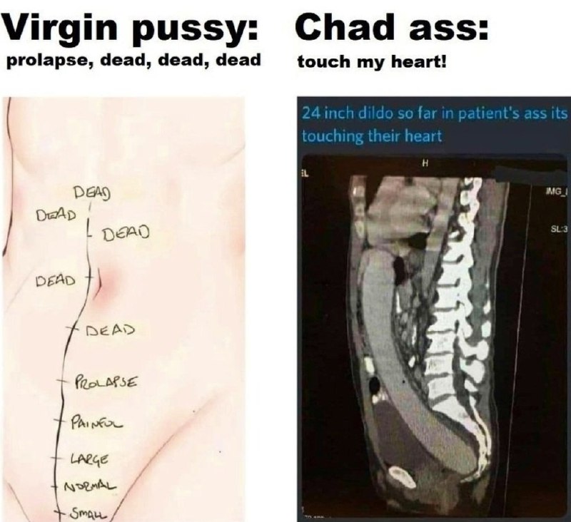 from Memes via Schädelstätte