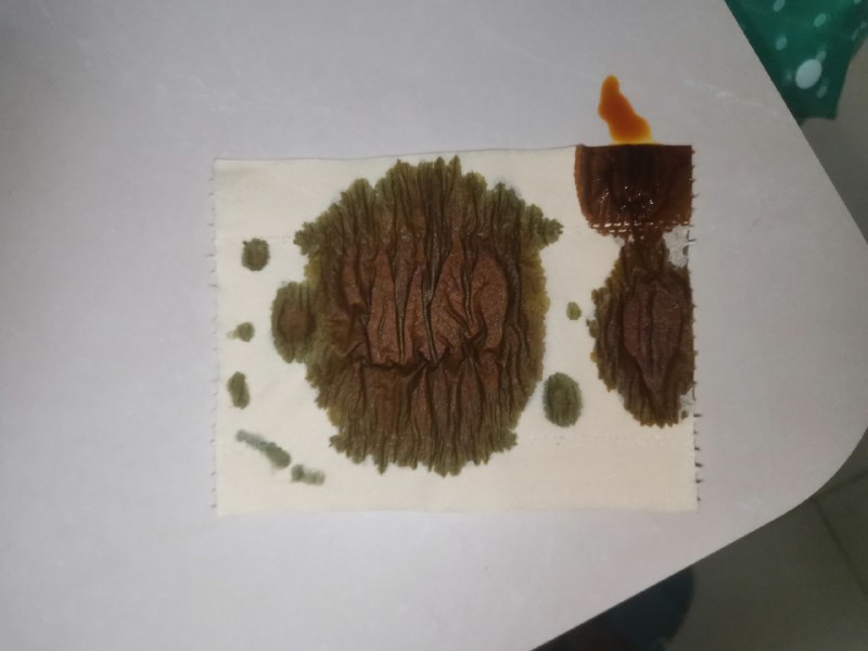 涂碘伏时观察到滴到竹浆纸上会发生碘与淀粉的显色反应，而木浆纸不会（P2是右上角刚洒上去和左侧等了一会已发生反应的对比）（手机没防抖手还有伤谅解一下）涂碘伏时观察到滴到竹浆纸上会发生碘与淀粉的显色反应，而木浆纸不会（P2是右上角刚洒上去和左侧等了一会已发生反应的对比）（手机没防抖手还有伤谅解一下）