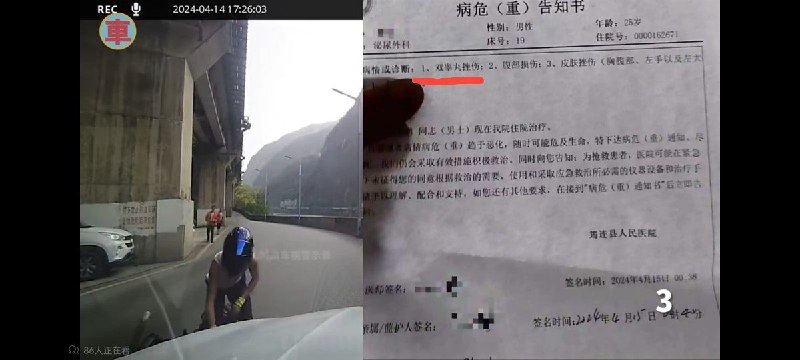《爆丸小子》
