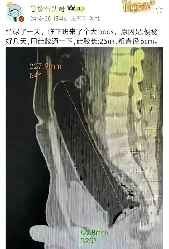 via 不会飞的麻将