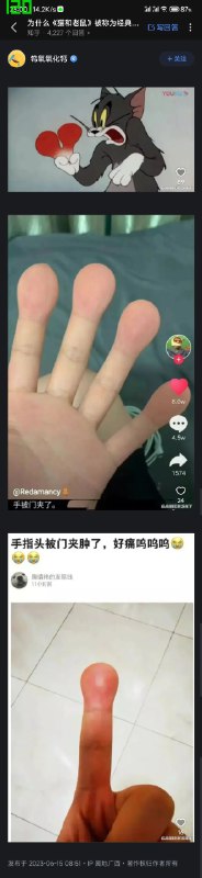 手居然真的会被夹成这样？