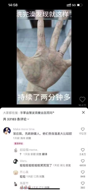 via 7号沙雕网友